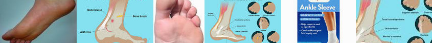 a (foot) Treatment, Everything Know You Ankle Walgreens Causes, Wikipedia Need Doctor About Foot and